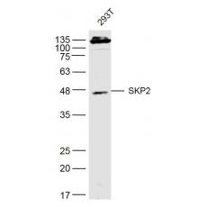 Anti-SKP2 antibody