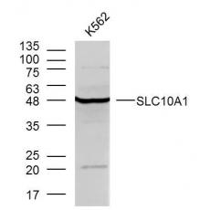 Anti-SLC10A1 antibody