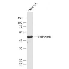 Anti-SIRP Alpha antibody