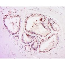 Anti-POLR3C antibody