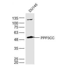 Anti-PPP3CC antibody