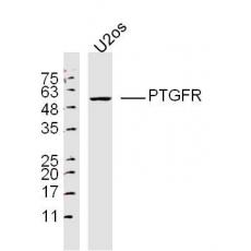 Anti-PTGFR antibody