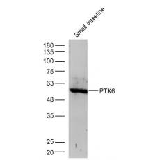 Anti-PTK6 antibody