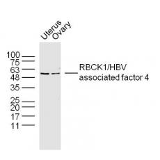 Anti-RBCK1/HBV associated factor 4 antibody