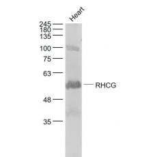 Anti-RHCG antibody