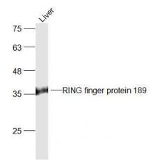 Anti-RING finger protein 189 antibody
