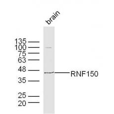 Anti-RNF126 antibody