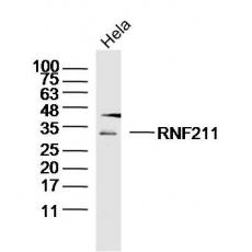 Anti-RNF211 antibody