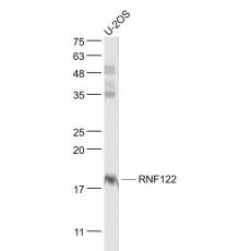Anti-RNF122 antibody