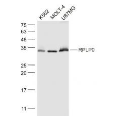 Anti-RPLP0 antibody