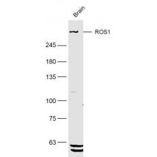 Anti-ROS1 antibody