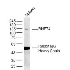 Anti-RNF74 antibody