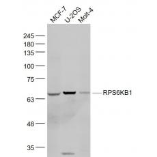 Anti-RPS6KB1 antibody