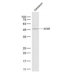 Anti-SC65 antibody