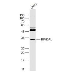 Anti-RPH3AL antibody