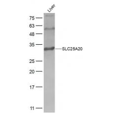 Anti-SLC25A20 antibody