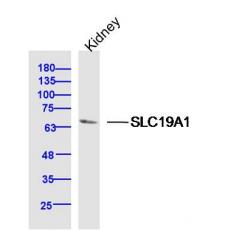 Anti-SLC19A1 antibody