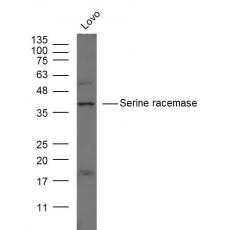 Anti-Serine racemase antibody