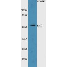 Anti-SLC7A9 antibody