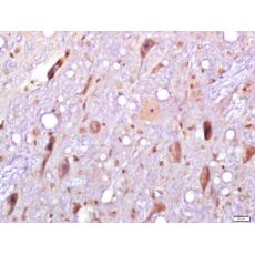 Anti-SLC38A2 antibody