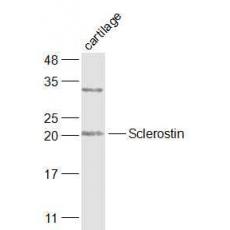 Anti-Sclerostin antibody