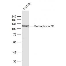 Anti-Semaphorin 3E antibody