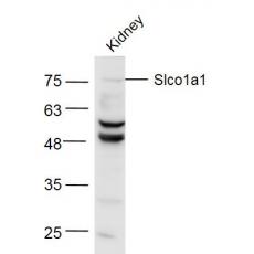 Anti-Slco1a1 antibody