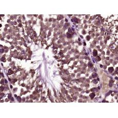 Anti-Thrombin receptor/ PAR1 antibody