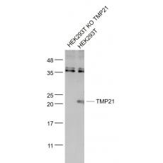 Anti-TMP21 antibody