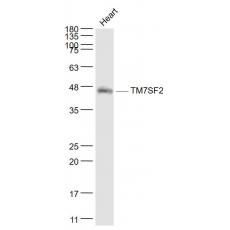 Anti-TM7SF2 antibody