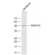 Anti-TMEFF2 antibody