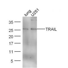 Anti-TRAIL antibody