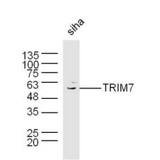 Anti-TRIM7 antibody