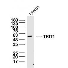 Anti-TRIT1 antibody