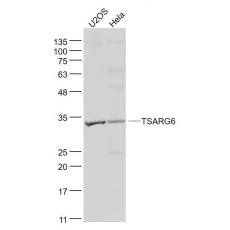 Anti-TSARG6 antibody