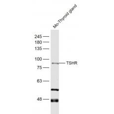 Anti-TSHR antibody