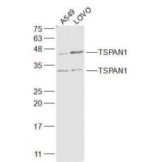 Anti-TSPAN1 antibody
