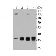 Anti-Aldolase B antibody