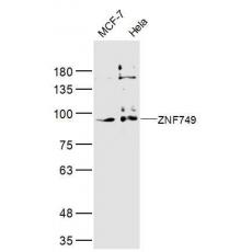 Anti-ZNF749 antibody