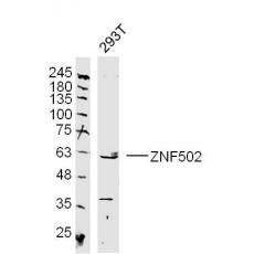 Anti-ZNF502 antibody