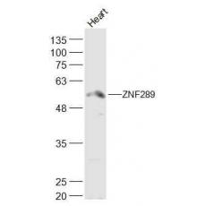 Anti-ZNF289/ARFGAP2 antibody