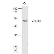 Anti-ZNF596 antibody