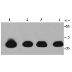 Anti-Cardiac Troponin /TTNNT2 antibody