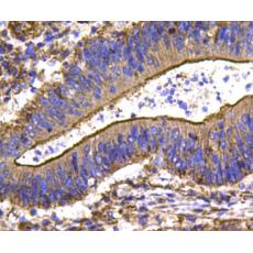 Anti-HSP27 antibody