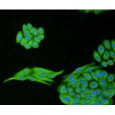 Anti-TGF-Beta 1 antibody