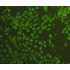 Anti-VEGF antibody