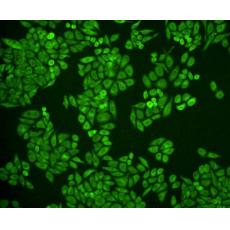 Anti-Catalase antibody