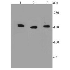 Anti-ROCK1 antibody