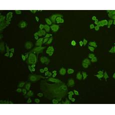 Anti-Stat-1 alpha/beta antibody