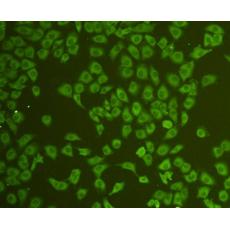 Anti-CD31 antibody